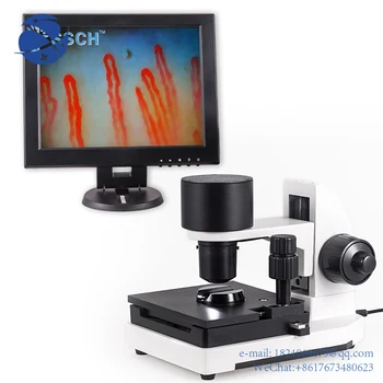 LCD цифров микроциркулационен микроскоп микроскоп цена биологичен микроскоп нокти гънка капилярна микроциркулация инспекция